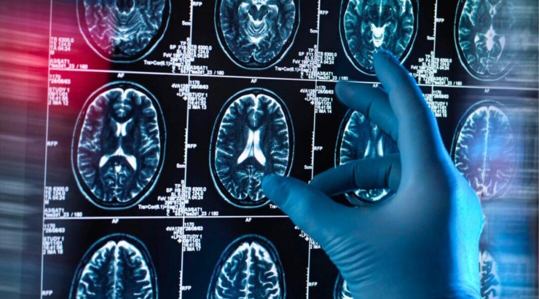 Deep Sleep: New Scientific Discovery Reveals Brain Shield Against Alzheimer's