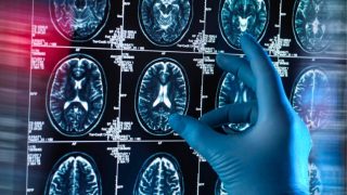 Deep Sleep: New Scientific Discovery Reveals Brain Shield Against Alzheimer's