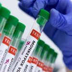 Second Monkeypox Death in Pakistan Reported in Faisalabad