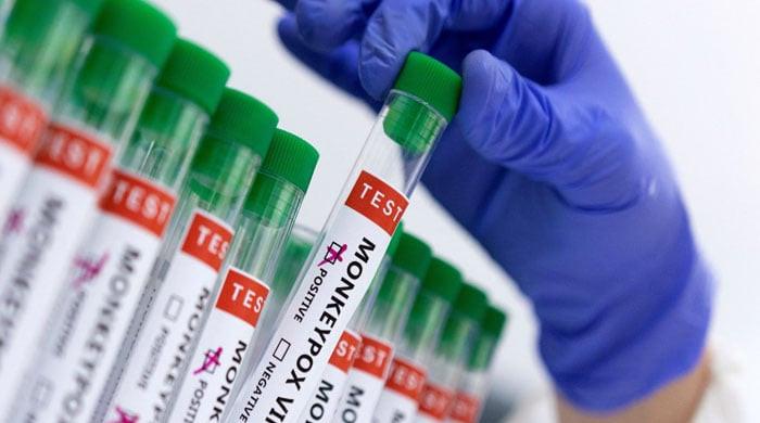 Second Monkeypox Death in Pakistan Reported in Faisalabad